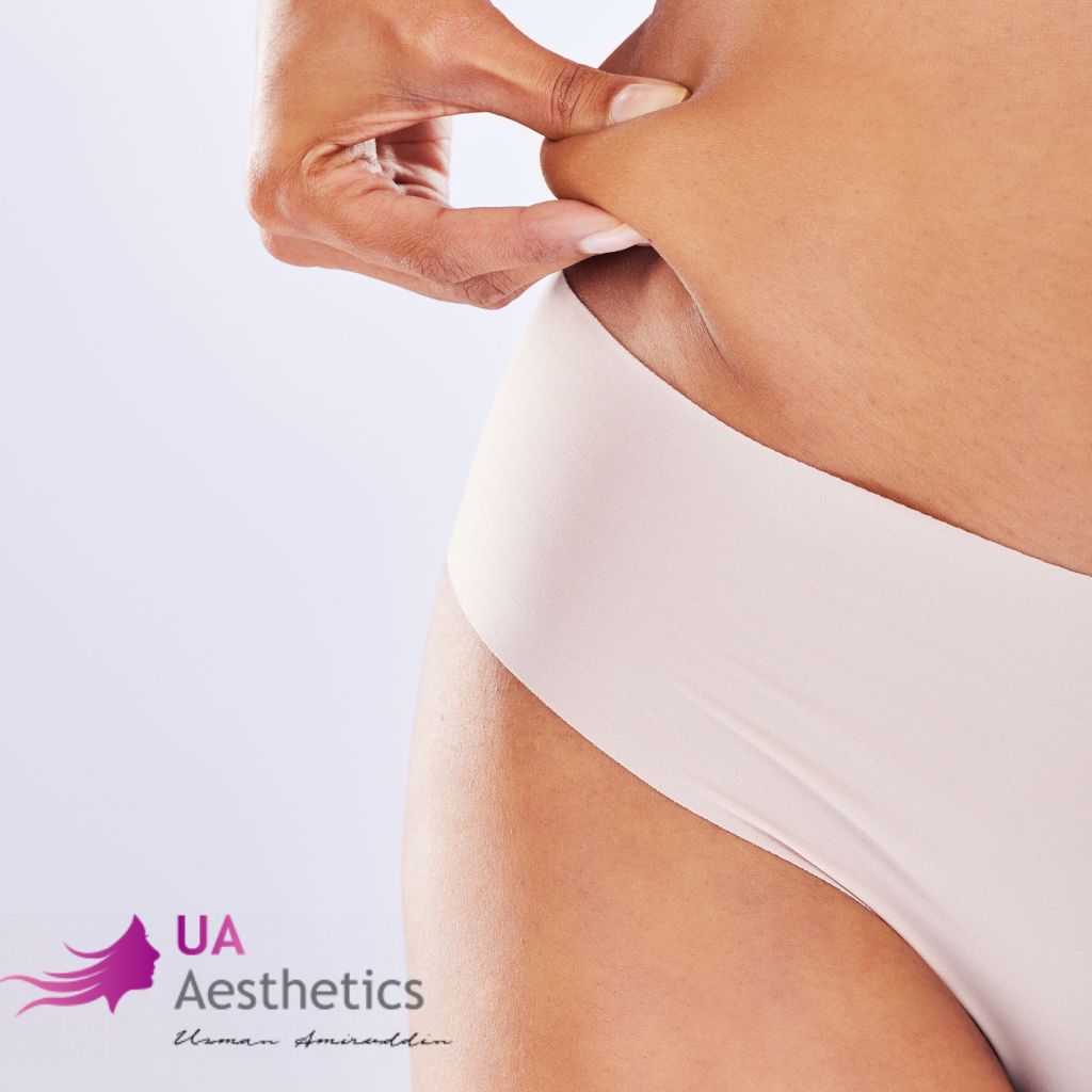 Aesthetics for Liposuction in Lahore?