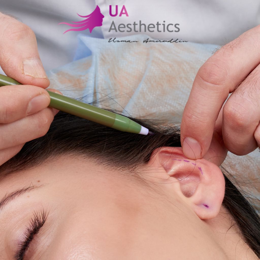 Otoplasty at UA Aesthetics in Lahore